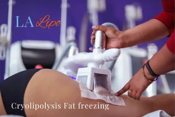 women getting fat freezing Newbury
