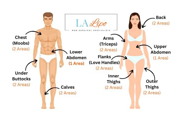 LA LIPO Cryolipolysis Areas Newbury