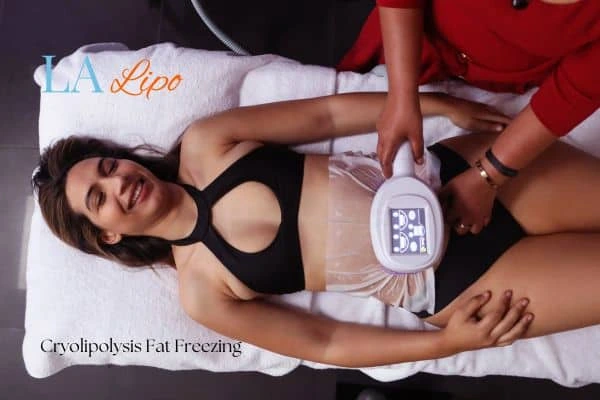 woman getting cryolipolysis Newbury