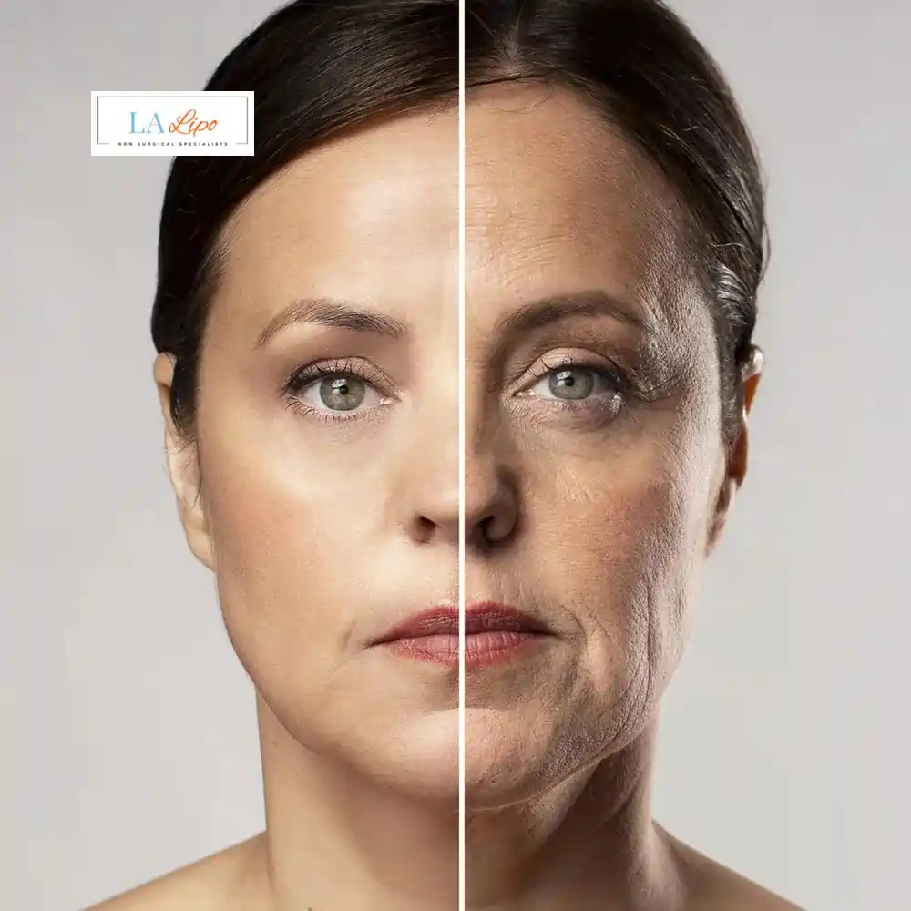 How Can You Tell If Non-Surgical Skin Tightening Is Right for You Newbury?
