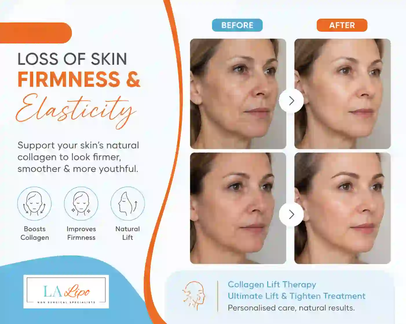 Sign #7: Loss of Skin Firmness and Elasticity Newbury